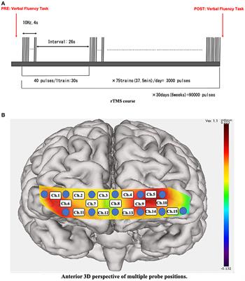 rTMS Therapy Reduces Hypofrontality in Patients With Depression as Measured by fNIRS